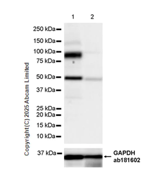 Western blot - Anti-Hormone sensitive lipase/HSL antibody [EPR27268-59] - BSA and Azide free (AB325348)