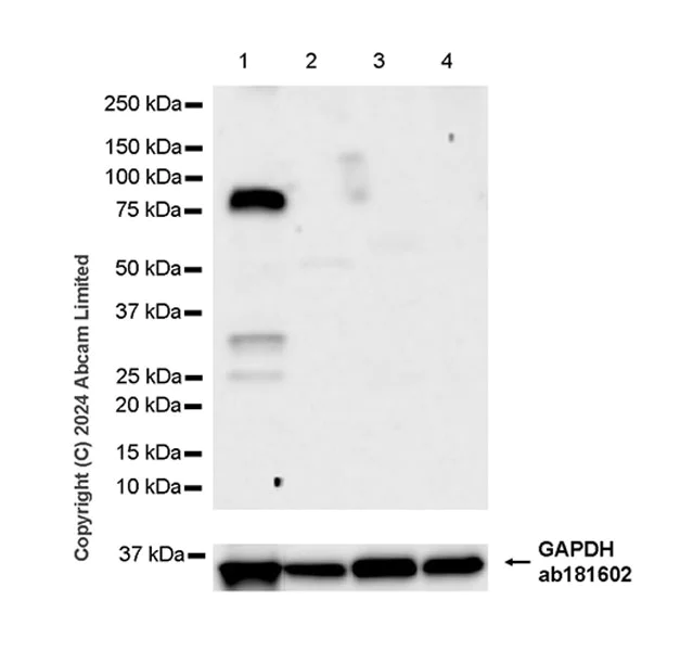 Western blot - Anti-Hormone sensitive lipase/HSL antibody [EPR27268-74] (AB322344)