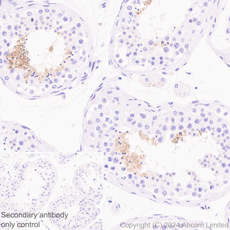 Immunohistochemistry (Formalin/PFA-fixed paraffin-embedded sections) - Anti-Hormone sensitive lipase/HSL antibody [EPR27268-74] - BSA and Azide free (AB324788)