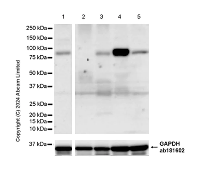 Western blot - Anti-Hormone sensitive lipase/HSL antibody [EPR27268-74] - BSA and Azide free (AB324788)