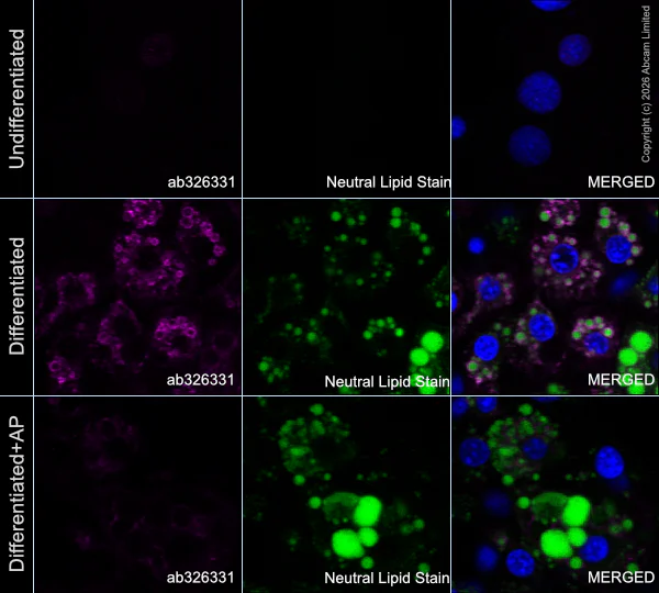 Immunocytochemistry/ Immunofluorescence - Anti-Hormone sensitive lipase/HSL (phospho S660) antibody [EPR30648-593] (AB326331)