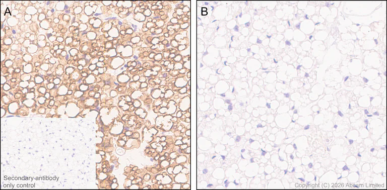 Immunohistochemistry (Formalin/PFA-fixed paraffin-embedded sections) - Anti-Hormone sensitive lipase/HSL (phospho S660) antibody [EPR30648-593] (AB326331)