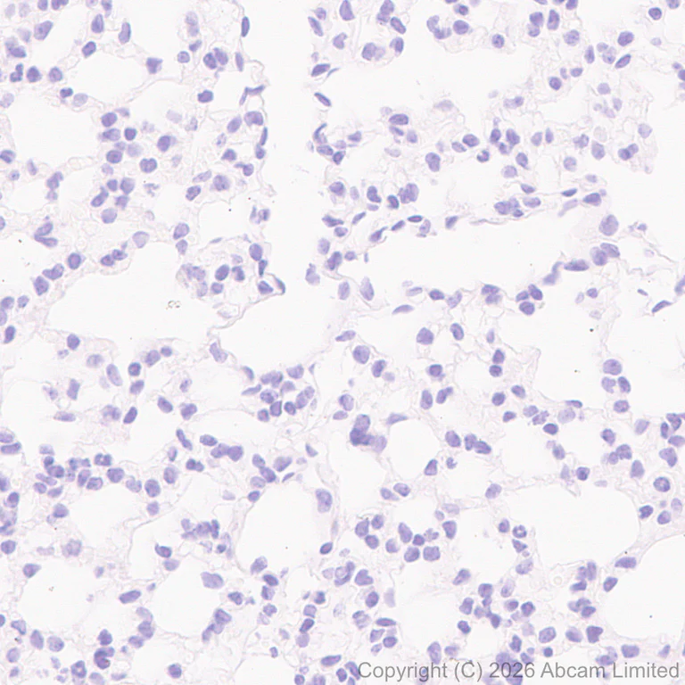 Immunohistochemistry (Formalin/PFA-fixed paraffin-embedded sections) - Anti-Hormone sensitive lipase/HSL (phospho S660) antibody [EPR30648-593] (AB326331)