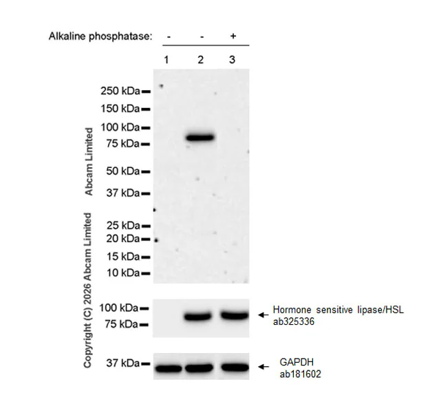 Western blot - Anti-Hormone sensitive lipase/HSL (phospho S660) antibody [EPR30648-593] (AB326331)