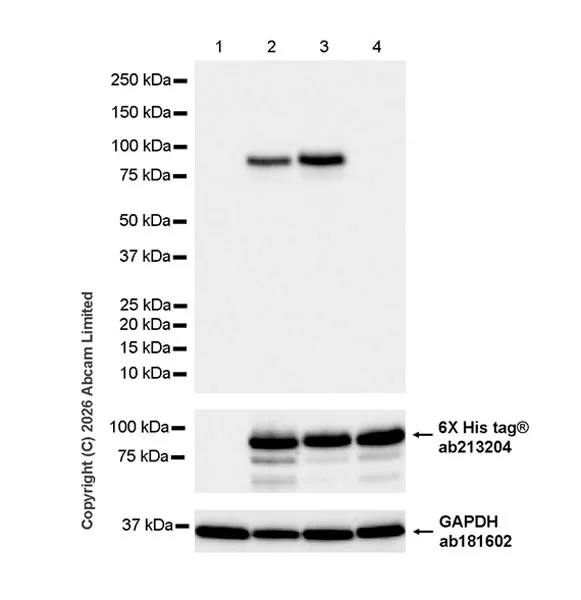 Western blot - Anti-Hormone sensitive lipase/HSL (phospho S660) antibody [EPR30648-593] (AB326331)