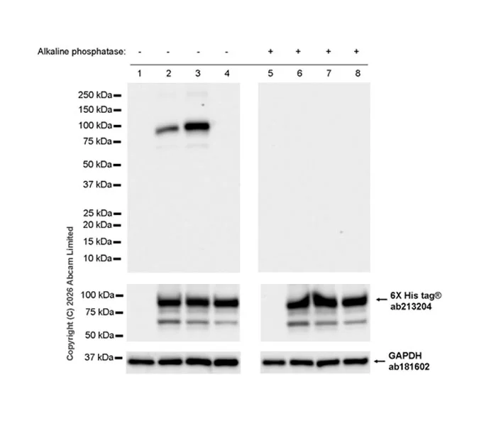 Western blot - Anti-Hormone sensitive lipase/HSL (phospho S660) antibody [EPR30648-593] (AB326331)
