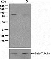 Western blot - Anti-Hormone sensitive lipase/HSL (phospho S853) antibody [EPR2329(2)] (AB109400)
