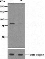 Western blot - Anti-Hormone sensitive lipase/HSL (phospho S853) antibody [EPR2329(2)] - BSA and Azide free (AB247849)