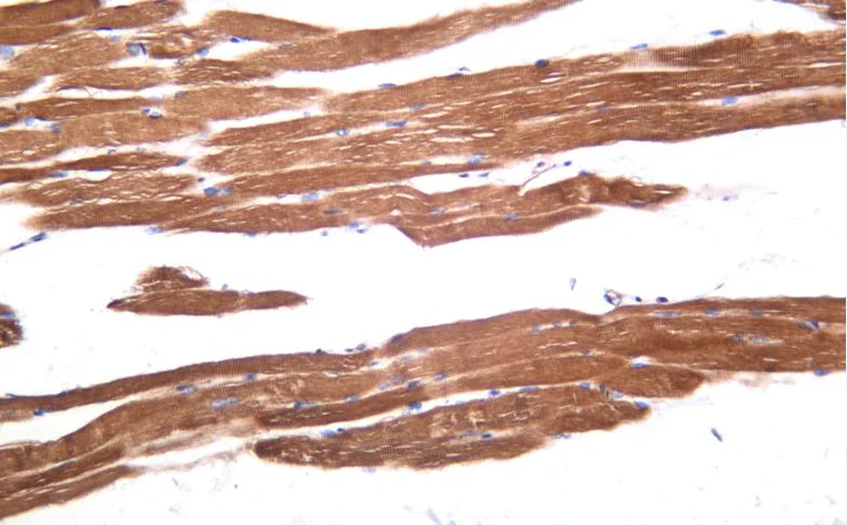 Immunohistochemistry (Formalin/PFA-fixed paraffin-embedded sections) - Anti-Hormone-sensitive lipase/HSL (phospho S853) antibody [SN06-39] (AB326625)