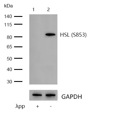 Western blot - Anti-Hormone-sensitive lipase/HSL (phospho S853) antibody [SN06-39] (AB326625)
