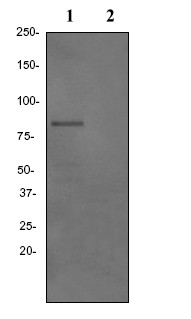 Western blot - Anti-Hormone sensitive lipase/HSL (phospho S855) antibody [EPR2330] (AB76492)