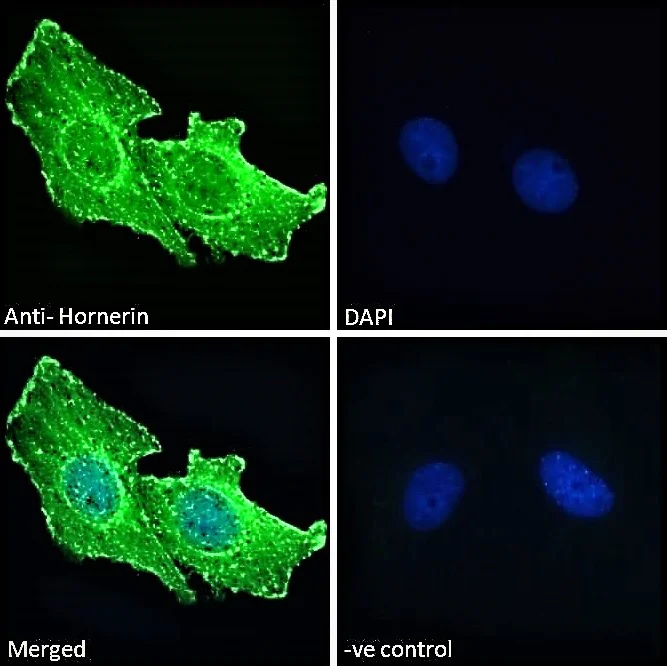 Immunocytochemistry/ Immunofluorescence - Anti-Hornerin antibody (AB78909)