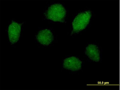 Immunocytochemistry/ Immunofluorescence - Anti-HOXA1 antibody (AB168179)
