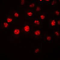 Immunocytochemistry/ Immunofluorescence - Anti-HOXA1 antibody (AB230513)