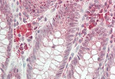 Immunohistochemistry (Formalin/PFA-fixed paraffin-embedded sections) - Anti-HOXA1 antibody (AB230513)