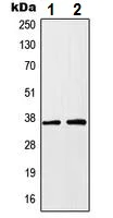 Western blot - Anti-HOXA1 antibody (AB230513)