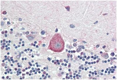 Immunohistochemistry (Formalin/PFA-fixed paraffin-embedded sections) - Anti-HOXA10 antibody (AB191470)