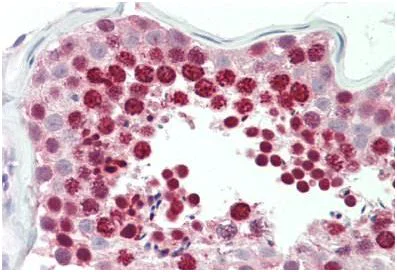 Immunohistochemistry (Formalin/PFA-fixed paraffin-embedded sections) - Anti-HOXA10 antibody (AB191470)