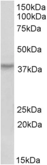 Western blot - Anti-HOXA10 antibody (AB191470)
