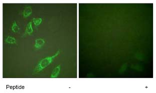 Immunocytochemistry/ Immunofluorescence - Anti-HOXA11 antibody (AB72591)