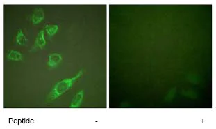 Immunocytochemistry/ Immunofluorescence - Anti-HOXA11 antibody (AB72591)