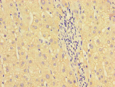 Immunohistochemistry (Formalin/PFA-fixed paraffin-embedded sections) - Anti-HOXA2 antibody (AB229960)