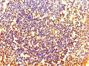 Immunohistochemistry (Formalin/PFA-fixed paraffin-embedded sections) - Anti-HOXA2 antibody (AB229960)