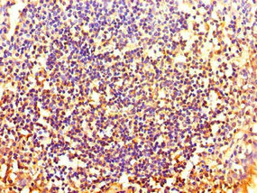 Immunohistochemistry (Formalin/PFA-fixed paraffin-embedded sections) - Anti-HOXA2 antibody (AB229960)