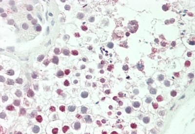 Immunohistochemistry (Formalin/PFA-fixed paraffin-embedded sections) - Anti-HOXA3 antibody - C-terminal (AB230879)