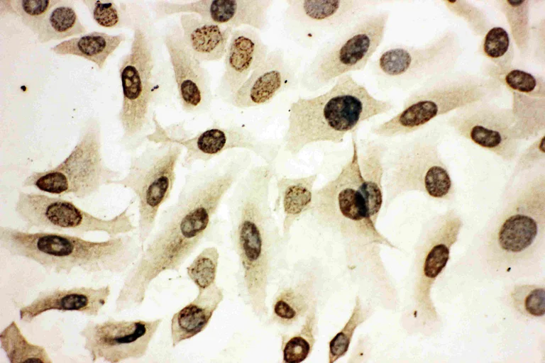 Immunocytochemistry/ Immunofluorescence - Anti-HOXA4 antibody (AB131049)