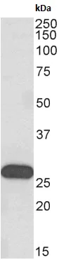 Western blot - Anti-HOXA6 antibody - N-terminal (AB180217)