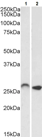 Western blot - Anti-HOXA6 antibody - N-terminal (AB180217)