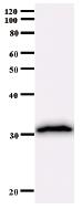 Western blot - Anti-HOXA7 antibody [743C1a] (AB51235)