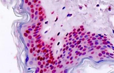 Immunohistochemistry (Formalin/PFA-fixed paraffin-embedded sections) - Anti-HOXA7 antibody (AB211521)