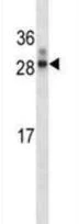 Western blot - Anti-HOXA7 antibody (AB211521)
