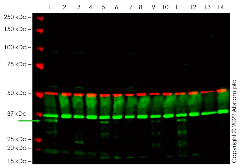 Western blot - Anti-HOXA9 antibody [EPR3655(2)] (AB140631)