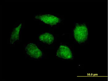 Immunocytochemistry/ Immunofluorescence - Anti-HOXB1 antibody (AB168279)