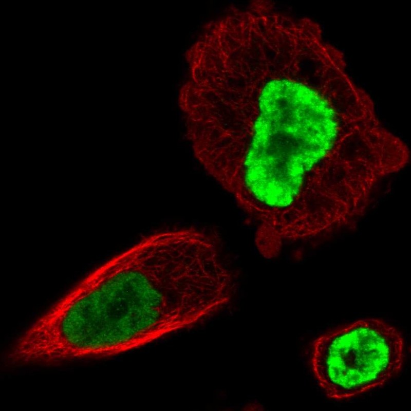 Immunocytochemistry/ Immunofluorescence - Anti-HOXB13 antibody (AB244529), expandable thumbnail