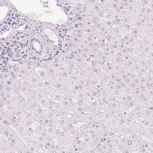 Immunohistochemistry (Formalin/PFA-fixed paraffin-embedded sections) - Anti-HOXB13 antibody (AB244529), expandable thumbnail