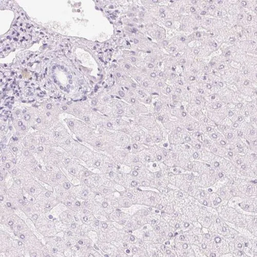 Immunohistochemistry (Formalin/PFA-fixed paraffin-embedded sections) - Anti-HOXB13 antibody (AB244529)