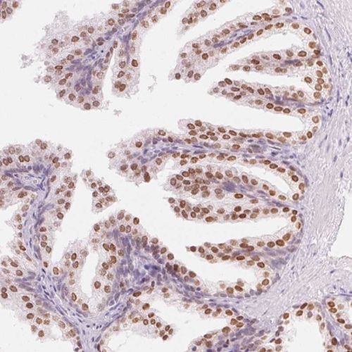 Immunohistochemistry (Formalin/PFA-fixed paraffin-embedded sections) - Anti-HOXB13 antibody (AB244529), expandable thumbnail
