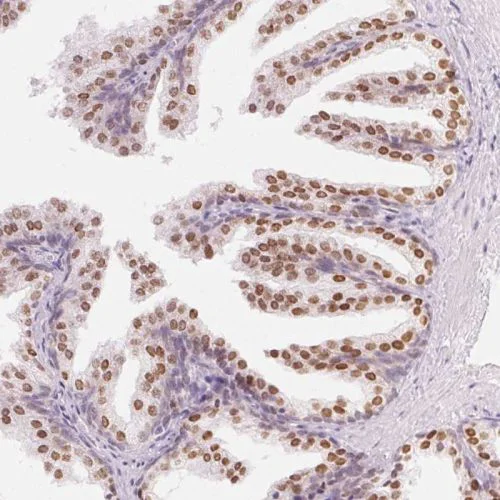 Immunohistochemistry (Formalin/PFA-fixed paraffin-embedded sections) - Anti-HOXB13 antibody (AB244529)