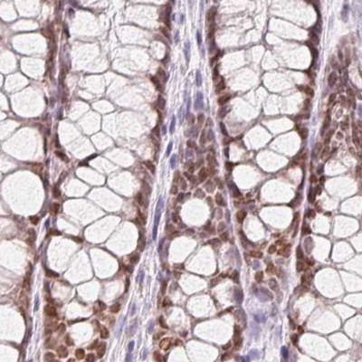 Immunohistochemistry (Formalin/PFA-fixed paraffin-embedded sections) - Anti-HOXB13 antibody (AB244529), expandable thumbnail