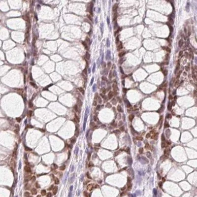 Immunohistochemistry (Formalin/PFA-fixed paraffin-embedded sections) - Anti-HOXB13 antibody (AB244529)