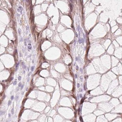 Immunohistochemistry (Formalin/PFA-fixed paraffin-embedded sections) - Anti-HOXB13 antibody (AB244529), expandable thumbnail