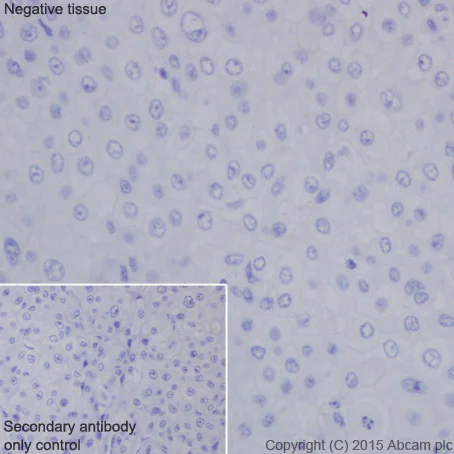 アトピロン Anti-HOXB13 antibody [EPR17371] (ab201682) | Abcam