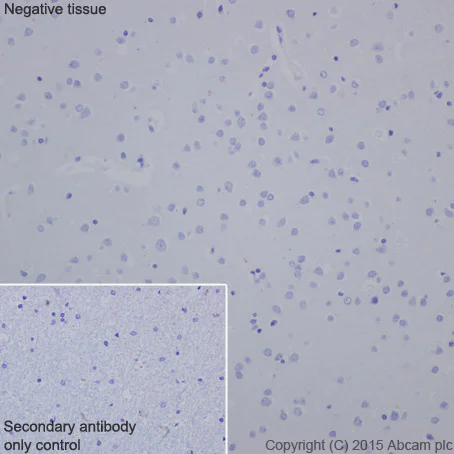 Immunohistochemistry (Formalin/PFA-fixed paraffin-embedded sections) - Anti-HOXB13 antibody [EPR17371] (AB201682)