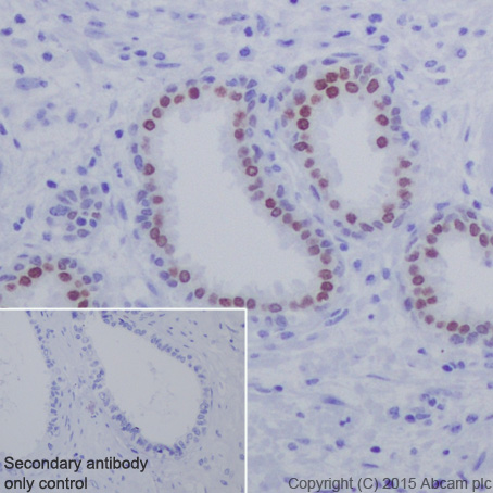Immunohistochemistry (Formalin/PFA-fixed paraffin-embedded sections) - Anti-HOXB13 antibody [EPR17371] (AB201682)