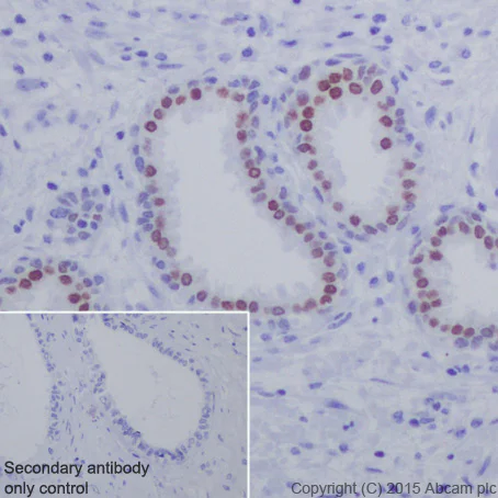 Immunohistochemistry (Formalin/PFA-fixed paraffin-embedded sections) - Anti-HOXB13 antibody [EPR17371] (AB201682)