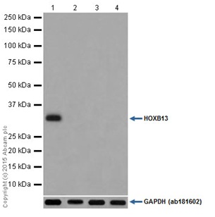 Anti-HOXB13 antibody [EPR17371] (ab201682) | Abcam